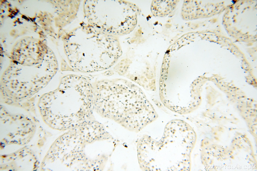 Immunohistochemistry (IHC) staining of human testis tissue using PM20D2 Polyclonal antibody (17705-1-AP)