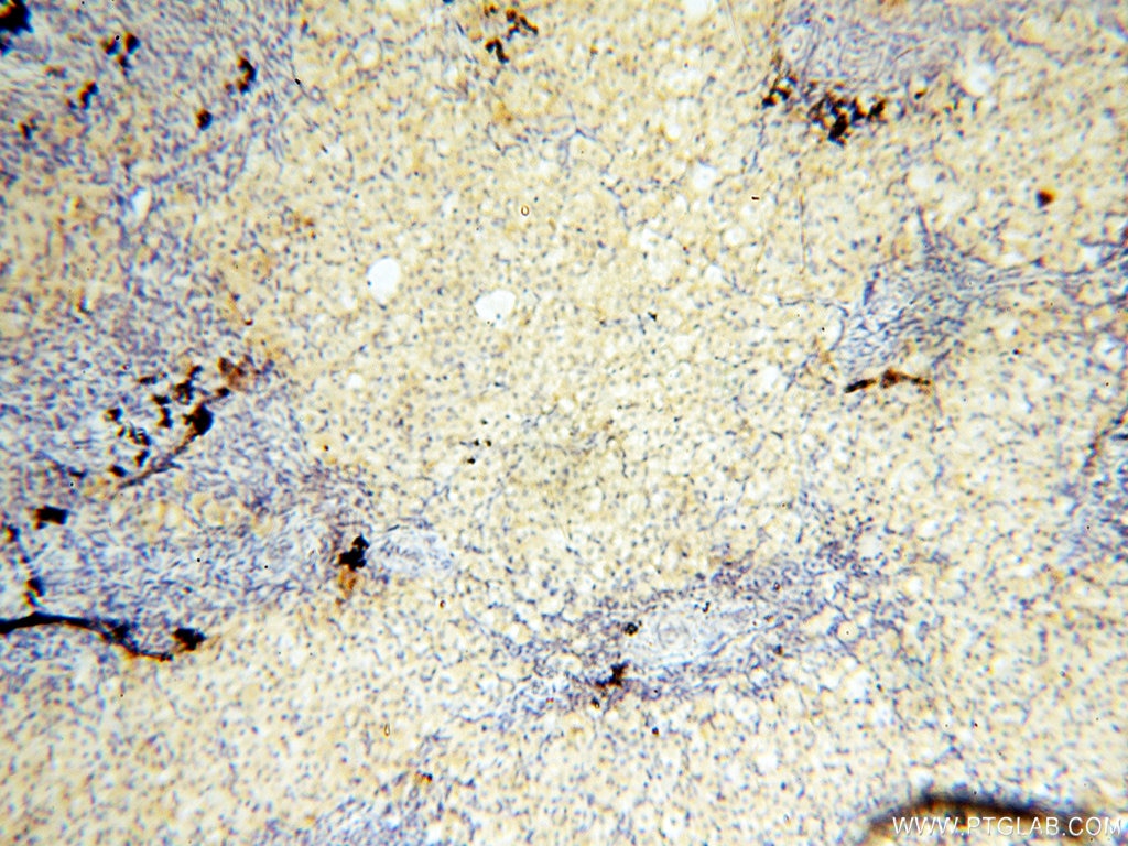 Immunohistochemistry (IHC) staining of human ovary tissue using PM20D2 Polyclonal antibody (17705-1-AP)