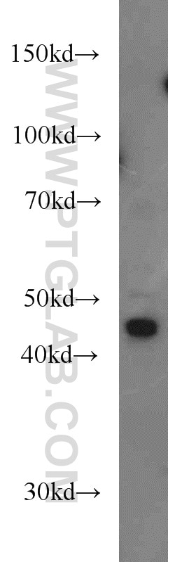 Western Blot (WB) analysis of HeLa cells using PM20D2 Polyclonal antibody (17705-1-AP)