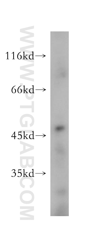 Western Blot (WB) analysis of HeLa cells using PM20D2 Polyclonal antibody (17705-1-AP)