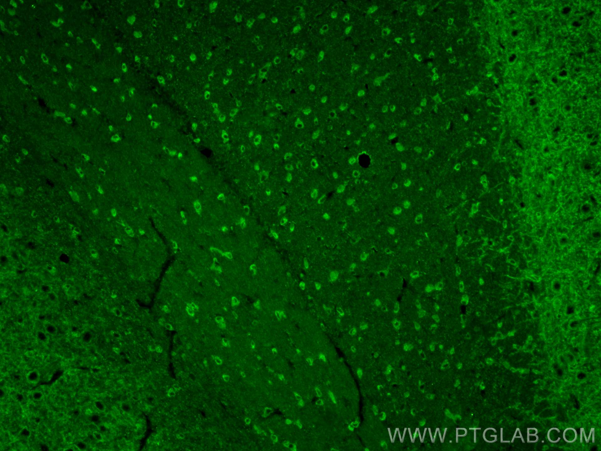 Immunofluorescence (IF) / fluorescent staining of rat brain tissue using PMCA2 Polyclonal antibody (28423-1-AP)