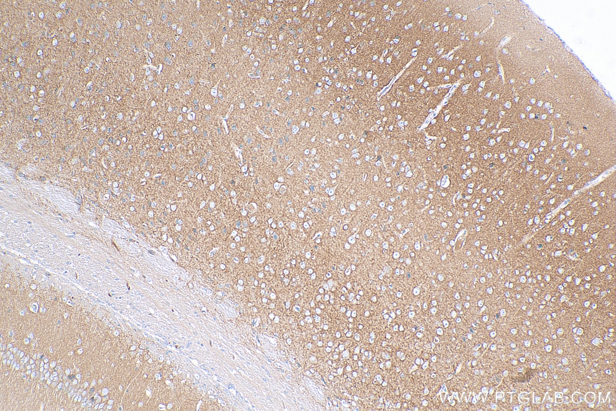 Immunohistochemistry (IHC) staining of mouse brain tissue using PMCA2 Polyclonal antibody (28423-1-AP)