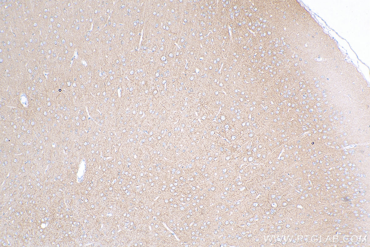 Immunohistochemistry (IHC) staining of rat brain tissue using PMCA2 Polyclonal antibody (28423-1-AP)