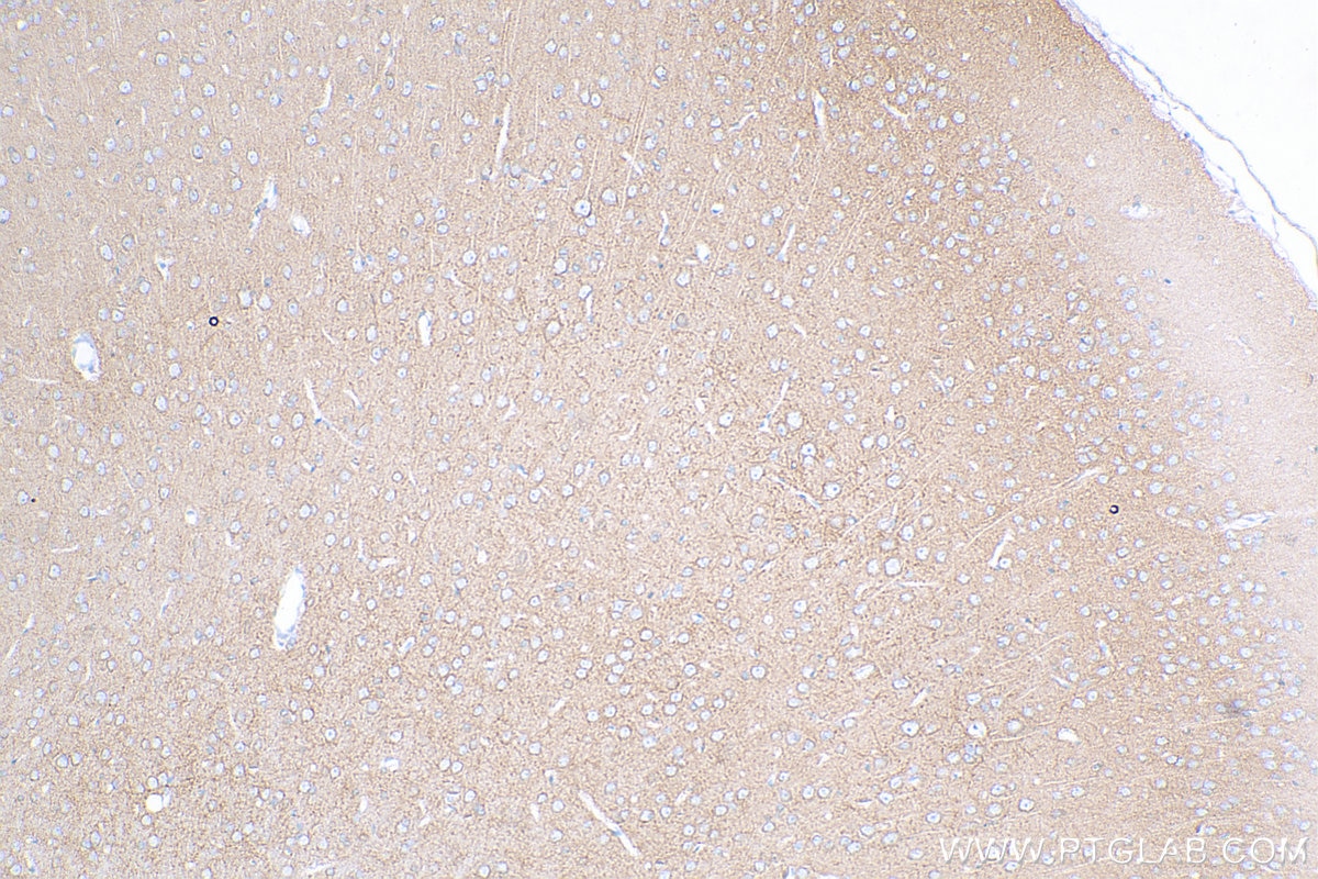 Immunohistochemistry (IHC) staining of rat brain tissue using PMCA2 Polyclonal antibody (28423-1-AP)
