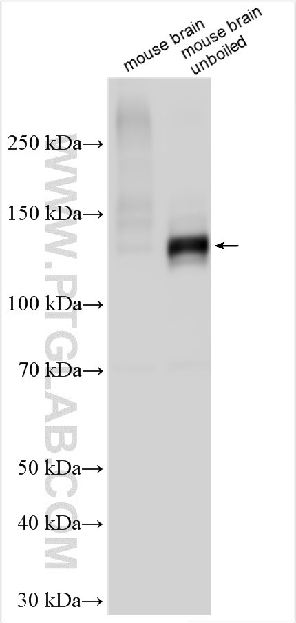 Western Blot (WB) analysis of various lysates using PMCA2 Polyclonal antibody (28423-1-AP)