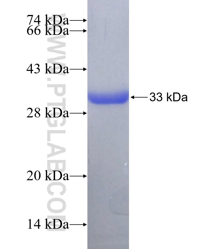PMEPA1 fusion protein Ag28777 SDS-PAGE