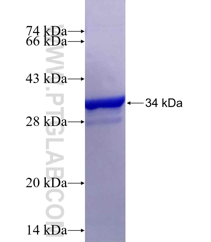 PMEPA1 fusion protein Ag29667 SDS-PAGE