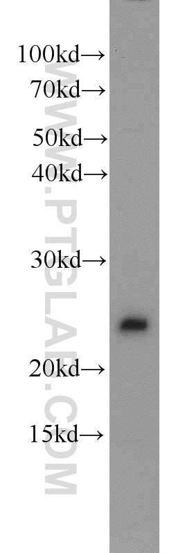 Western Blot (WB) analysis of Jurkat cells using PMF1 Polyclonal antibody (11190-2-AP)