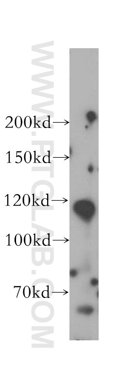 Western Blot (WB) analysis of mouse testis tissue using PMFBP1 Polyclonal antibody (17061-1-AP)