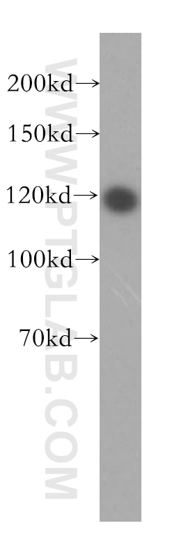 Western Blot (WB) analysis of HepG2 cells using PMFBP1 Polyclonal antibody (17061-1-AP)