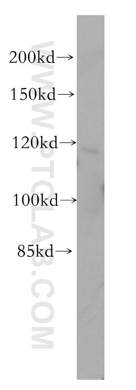 Western Blot (WB) analysis of MCF-7 cells using PMFBP1 Polyclonal antibody (17061-1-AP)