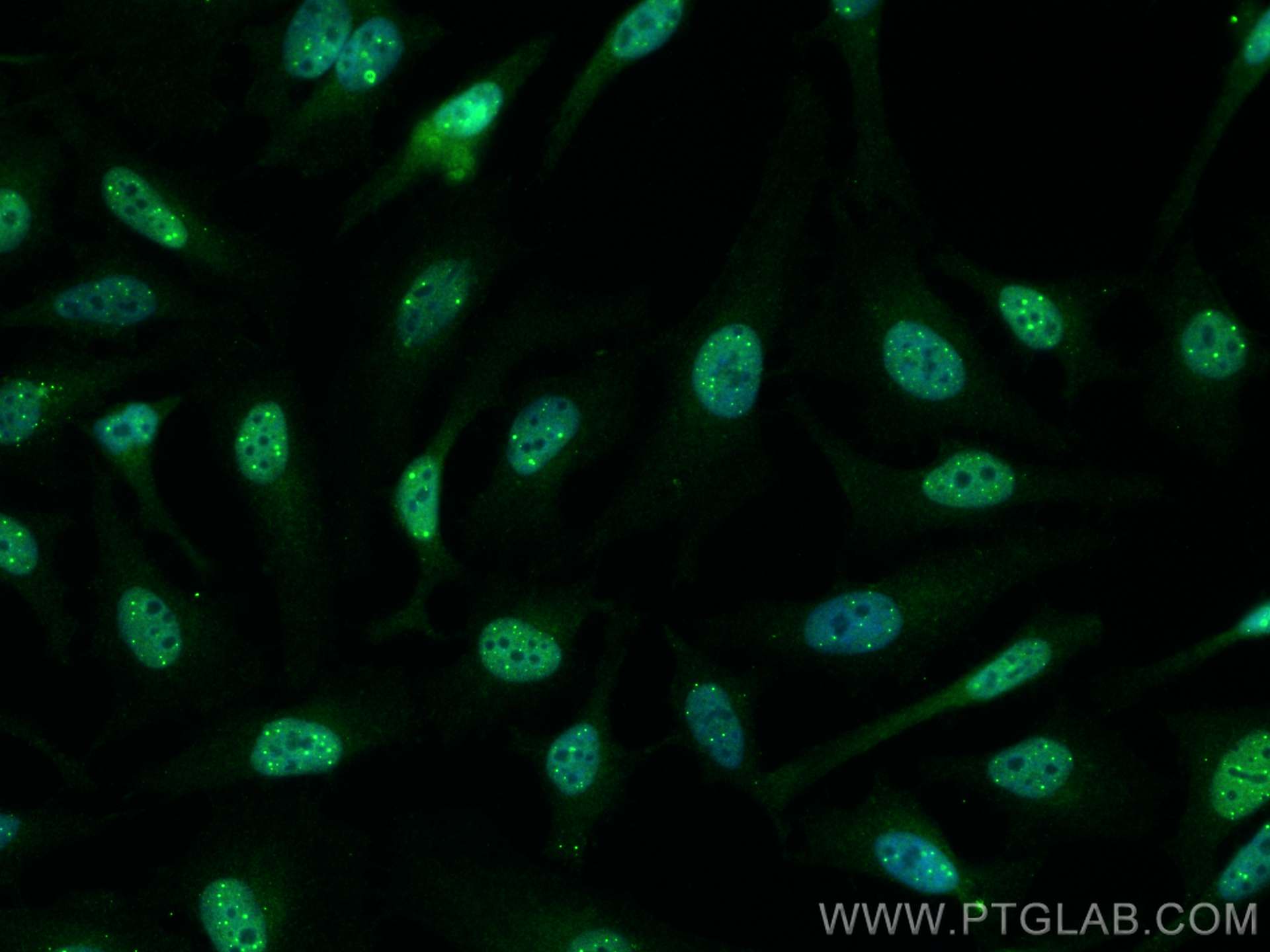 Immunofluorescence (IF) / fluorescent staining of HeLa cells using PML Polyclonal antibody (21041-1-AP)