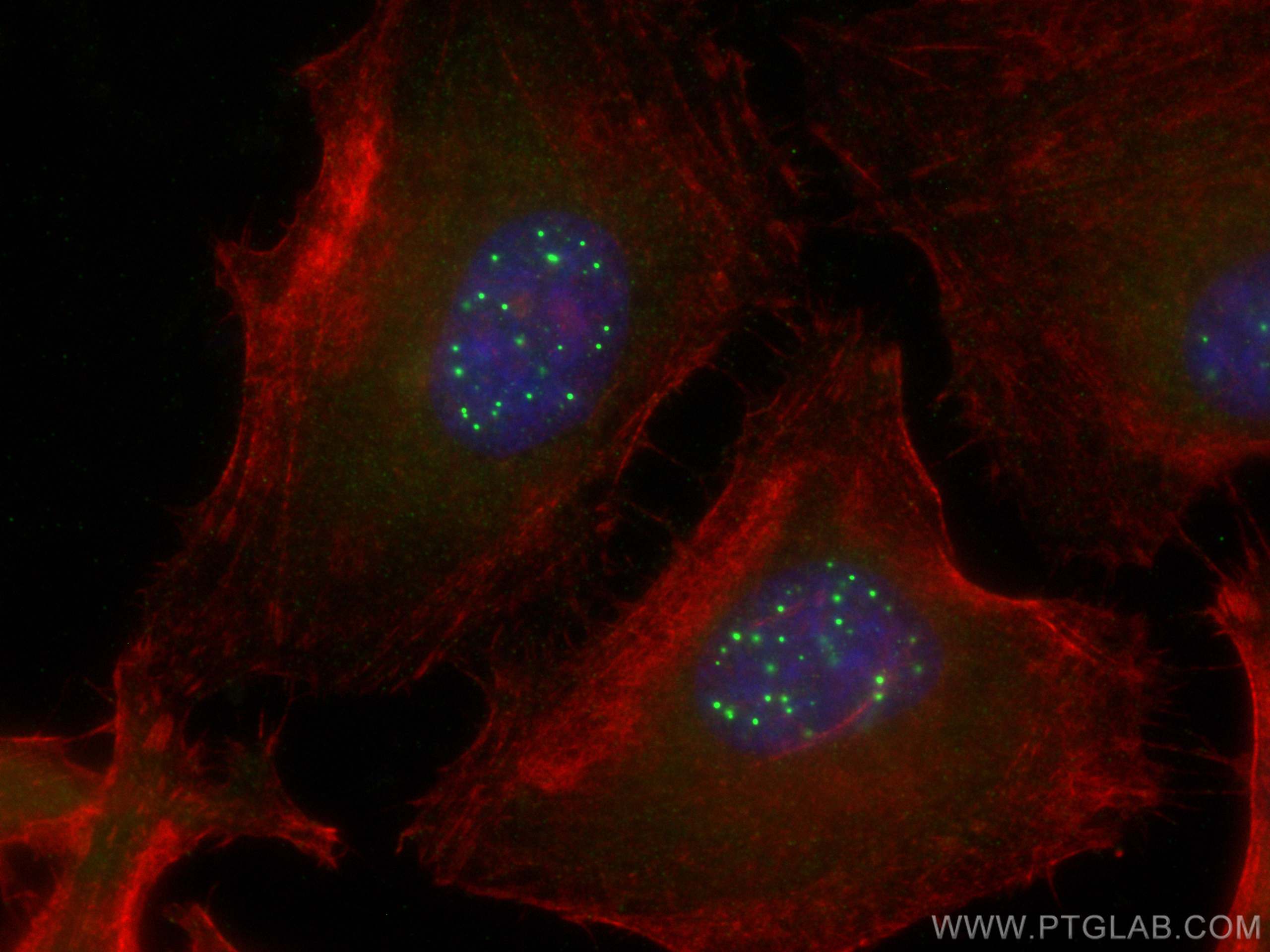 Immunofluorescence (IF) / fluorescent staining of HeLa cells using PML Polyclonal antibody (21041-1-AP)