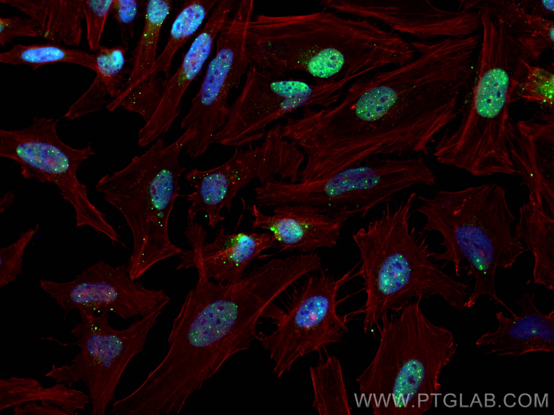 Immunofluorescence (IF) / fluorescent staining of HeLa cells using human PML Polyclonal antibody (21041-1-AP)