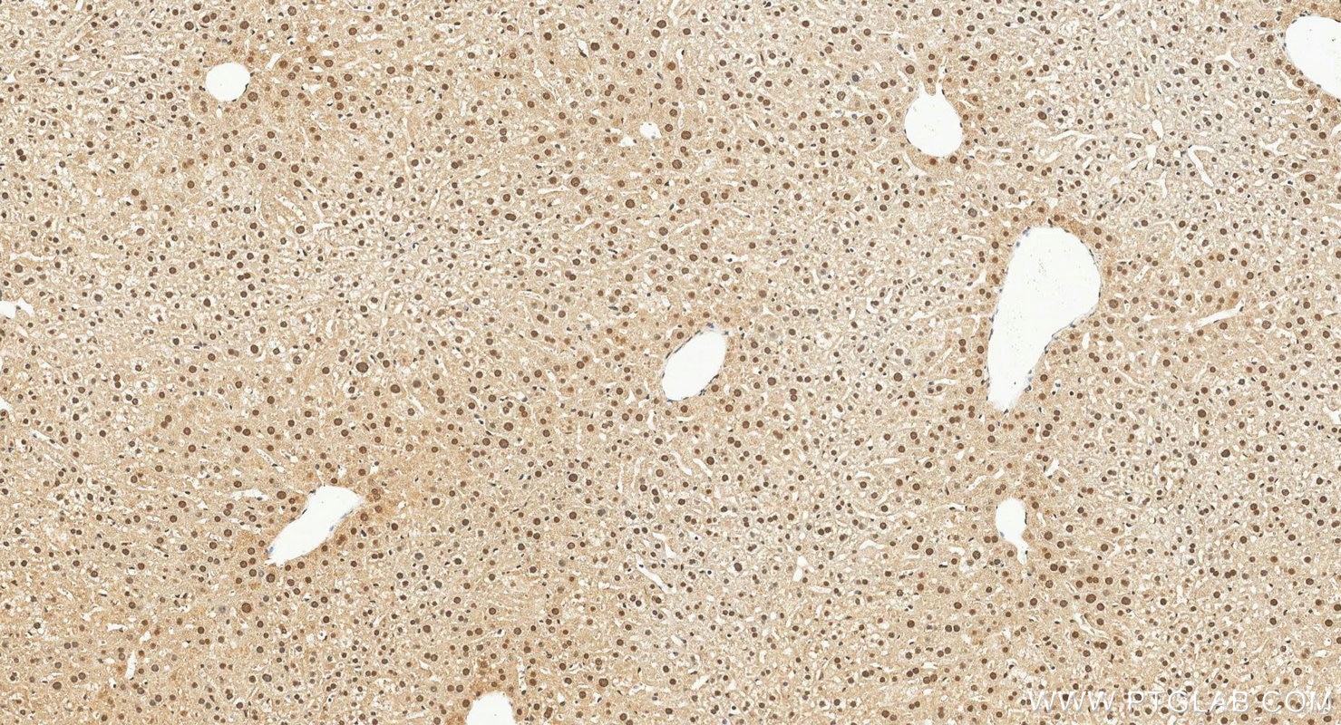 Immunohistochemistry (IHC) staining of mouse liver tissue using PML Polyclonal antibody (21041-1-AP)