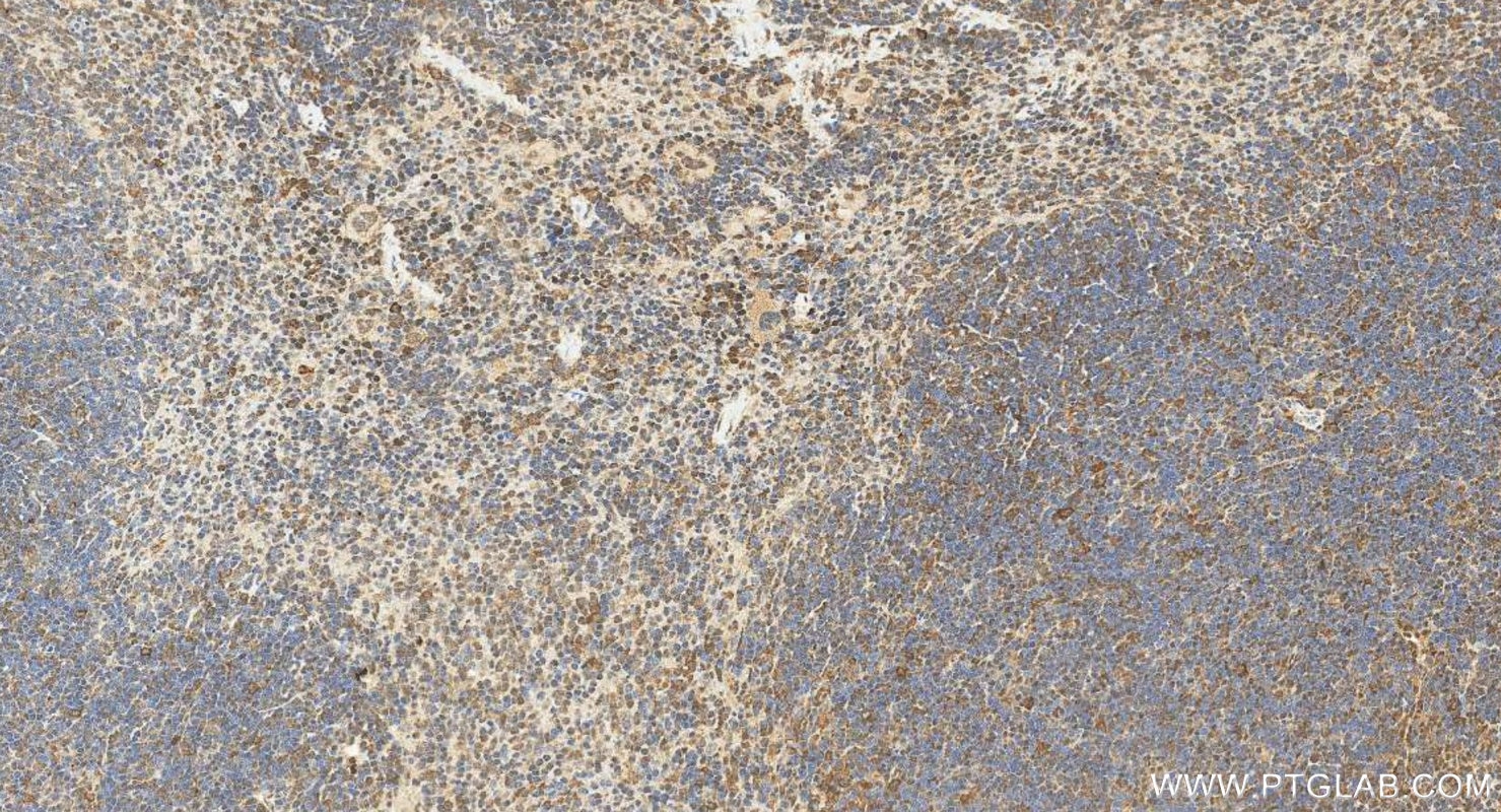 Immunohistochemistry (IHC) staining of mouse spleen tissue using PML Polyclonal antibody (21041-1-AP)