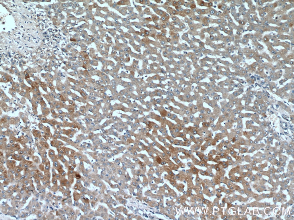 Immunohistochemistry (IHC) staining of human liver tissue using PML Polyclonal antibody (21041-1-AP)