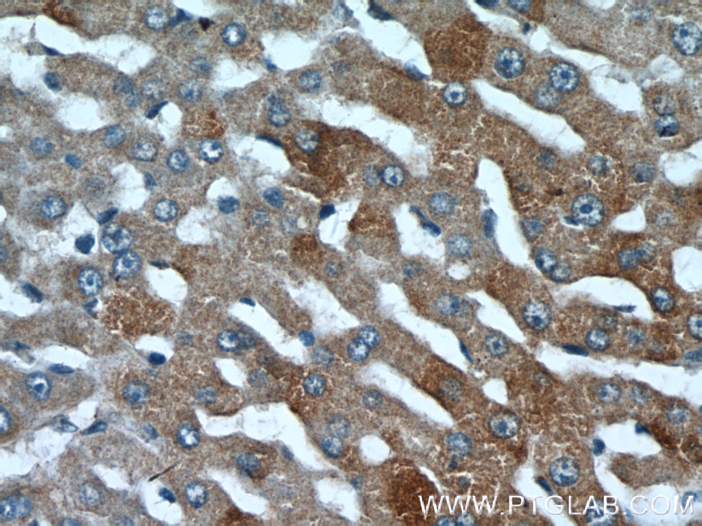 Immunohistochemistry (IHC) staining of human liver tissue using PML Polyclonal antibody (21041-1-AP)