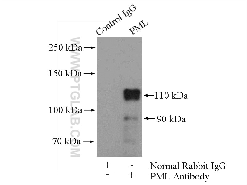 Immunoprecipitation (IP) experiment of HEK-293 cells using PML Polyclonal antibody (21041-1-AP)