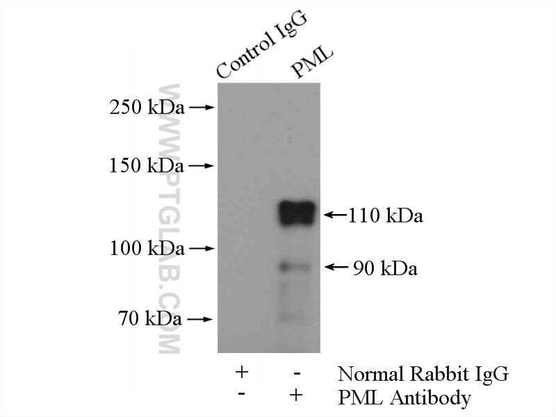 IP experiment of HEK-293 using 21041-1-AP