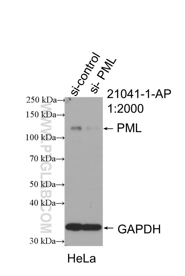 Western Blot (WB) analysis of HeLa cells using PML Polyclonal antibody (21041-1-AP)