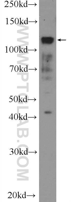 Western Blot (WB) analysis of HEK-293 cells using PML Polyclonal antibody (21041-1-AP)