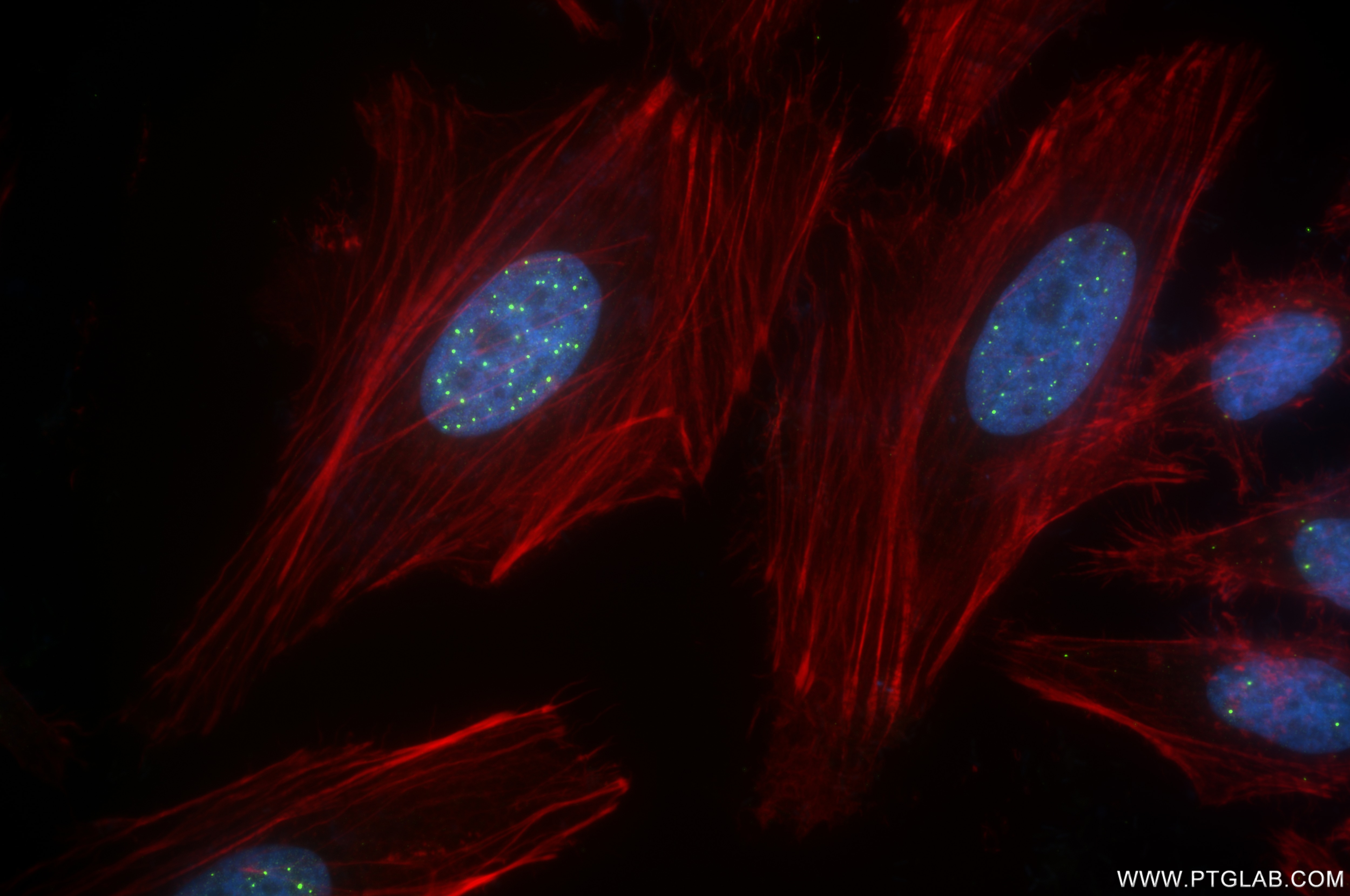 Immunofluorescence (IF) / fluorescent staining of HeLa cells using PML Recombinant antibody (85048-5-RR)