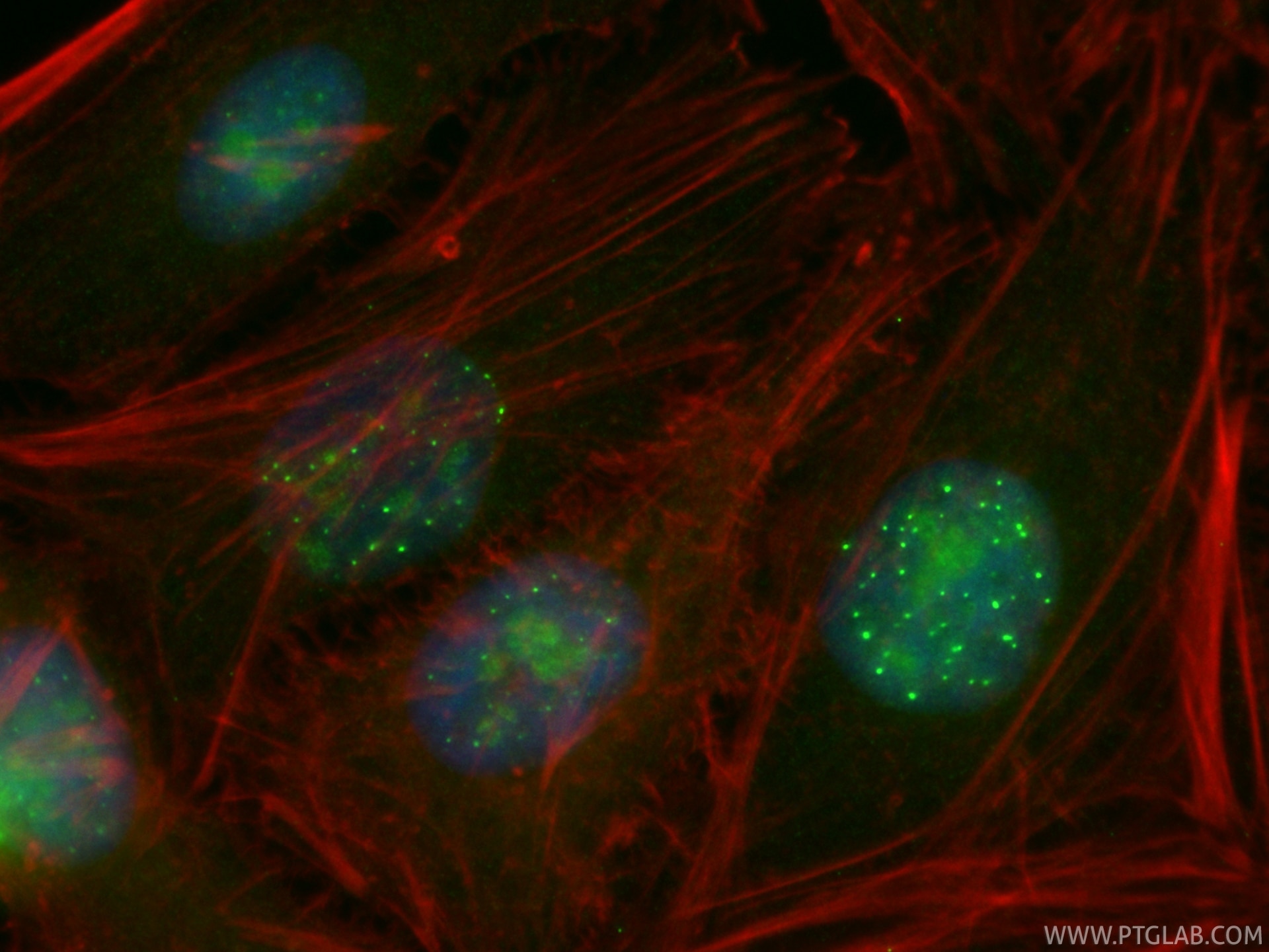 Immunofluorescence (IF) / fluorescent staining of HeLa cells using CoraLite® Plus 488-conjugated PML Recombinant mono (CL488-85048-5)
