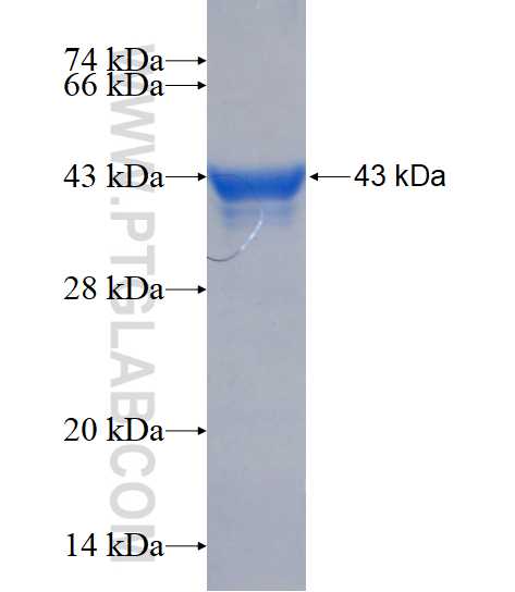PML fusion protein Ag16530 SDS-PAGE