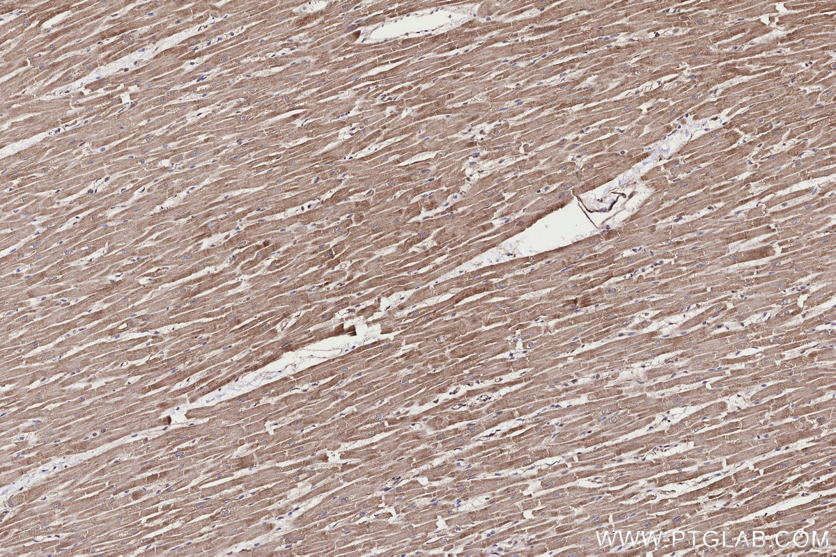 IHC staining of human heart using 11252-2-AP Immunohistochemistry (IHC) staining of human heart tissue using PMM1 Polyclonal antibody (11252-2-AP)
