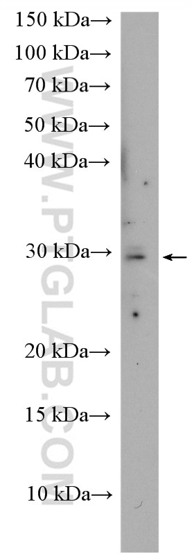 WB analysis of HepG2 using 11252-2-AP