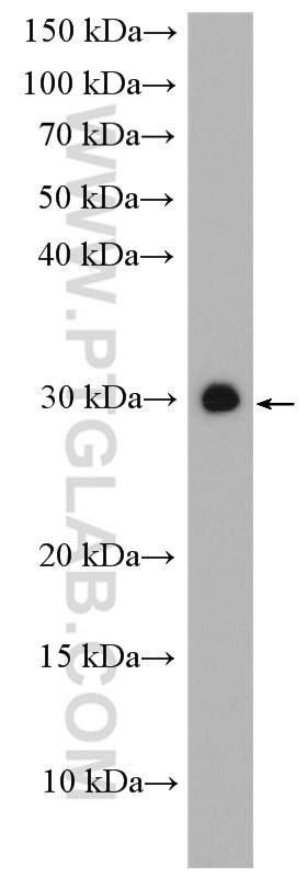 Western Blot (WB) analysis of mouse brain tissue using PMM1 Polyclonal antibody (11252-2-AP)