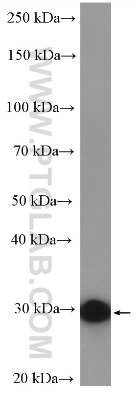 WB analysis of mouse brain using 11252-2-AP