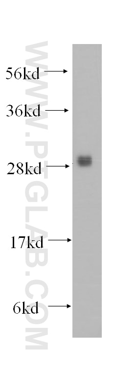 Western Blot (WB) analysis of human brain tissue using PMM1 Polyclonal antibody (11252-2-AP)