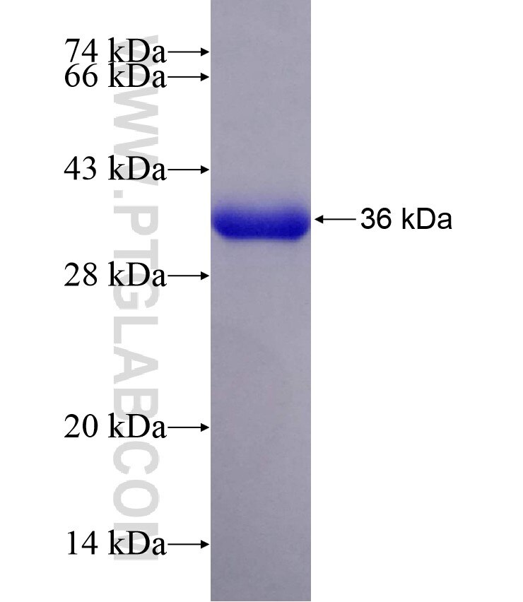 PMM1 fusion protein Ag29442 SDS-PAGE