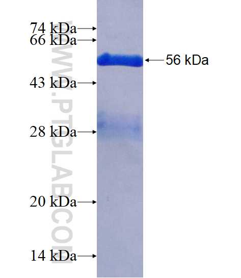 PMM1 fusion protein Ag1782 SDS-PAGE