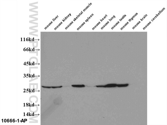 Western Blot (WB) analysis of multi-tissue using PMM2 Polyclonal antibody (10666-1-AP)