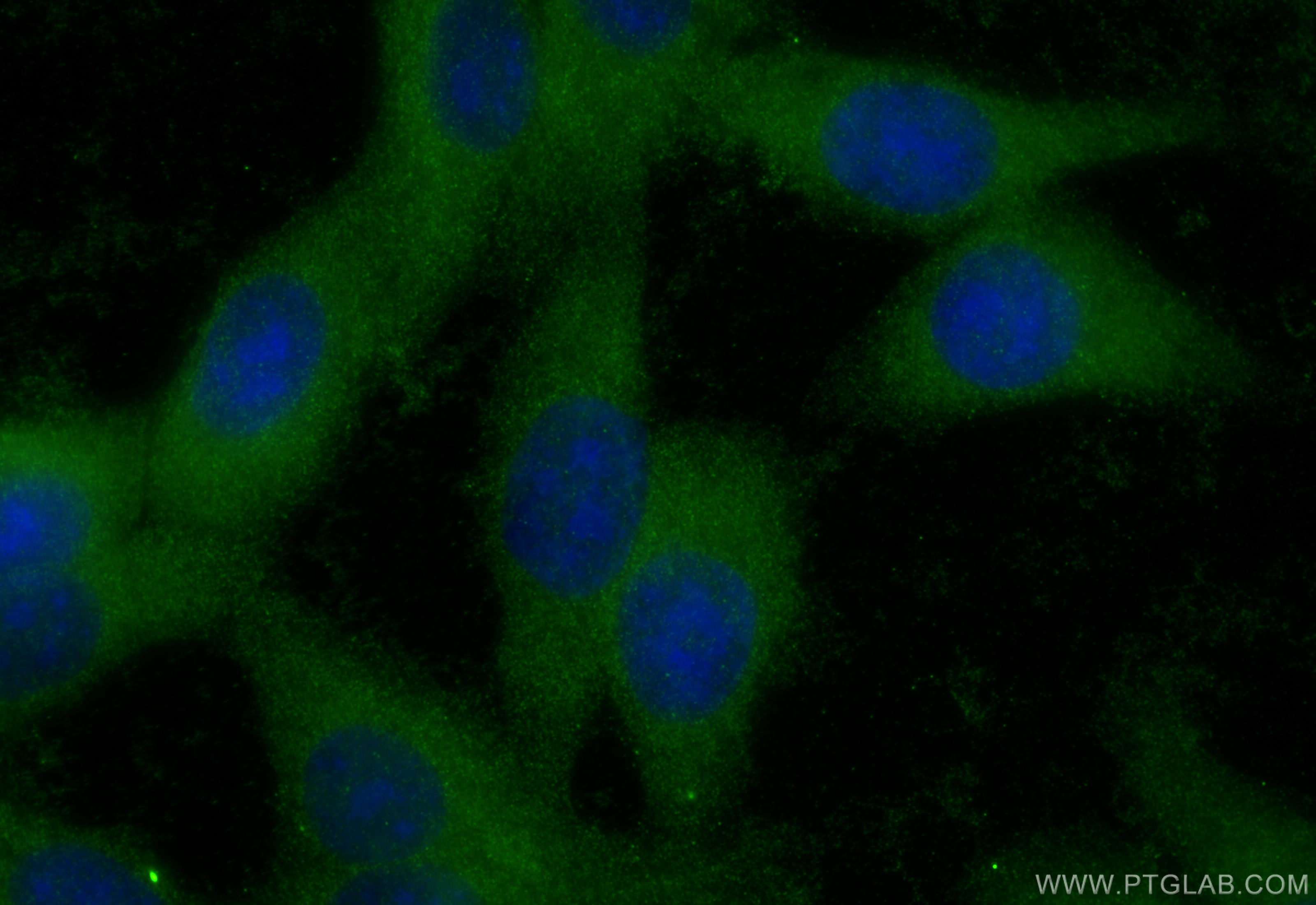 Immunofluorescence (IF) / fluorescent staining of HepG2 cells using PMM2 Polyclonal antibody (10666-1-AP)