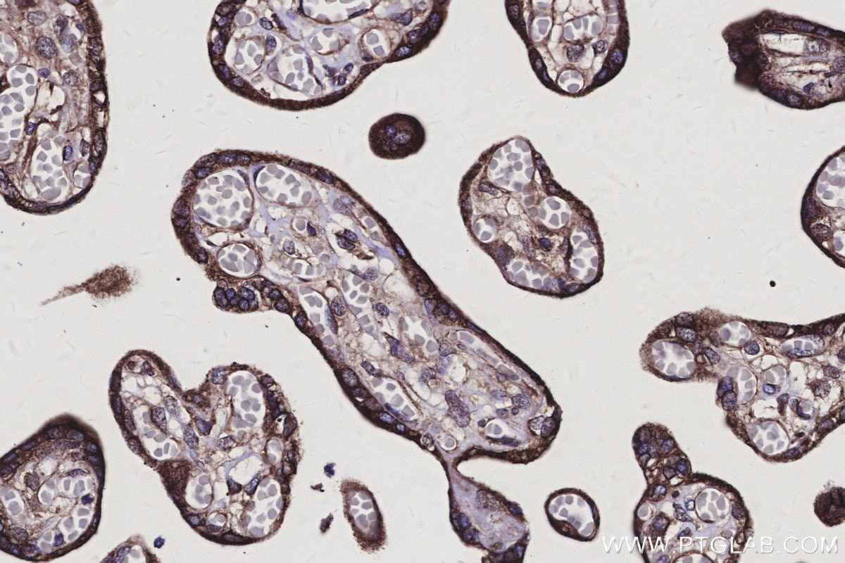 Immunohistochemistry (IHC) staining of human placenta tissue using PMM2 Polyclonal antibody (10666-1-AP)
