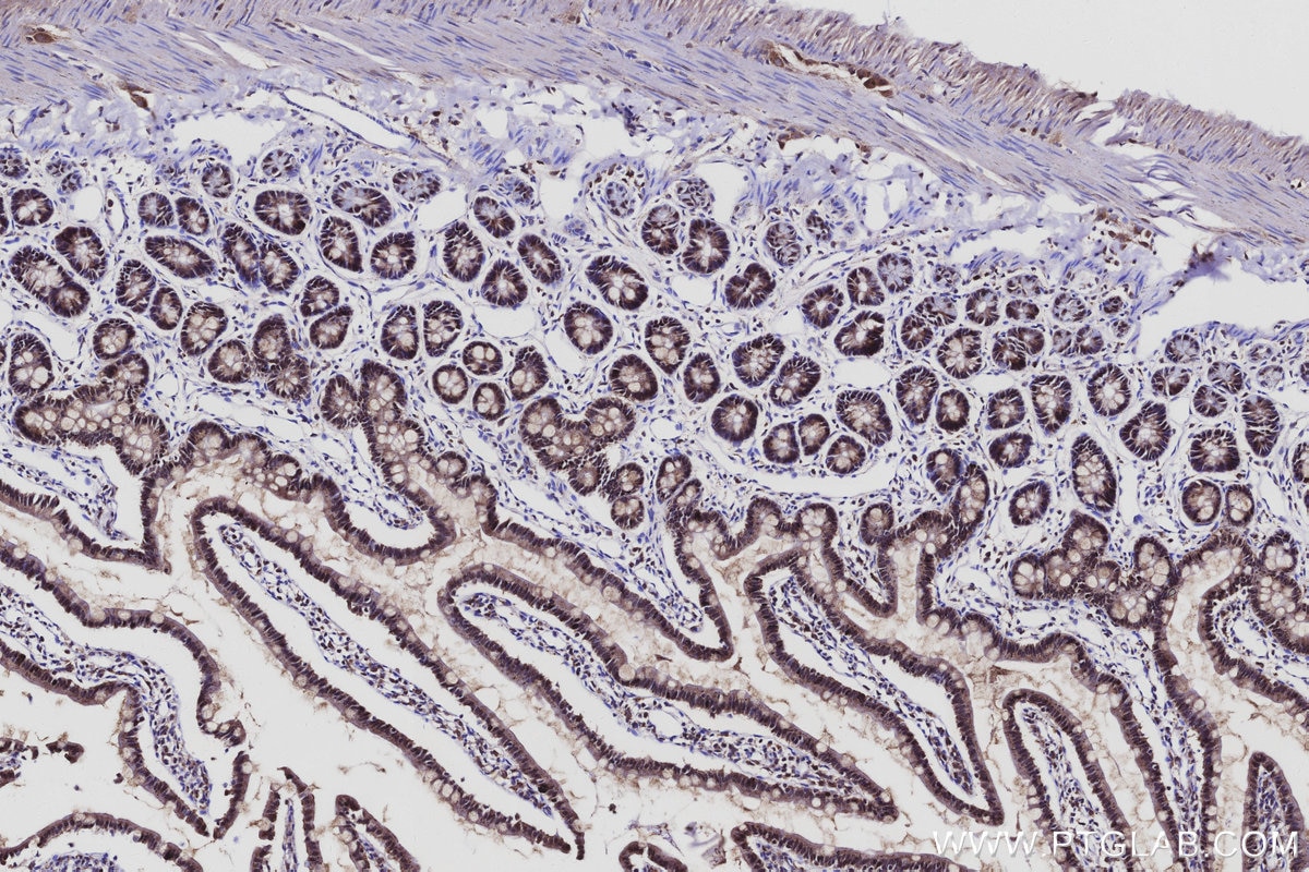 Immunohistochemistry (IHC) staining of rat small intestine tissue using PMM2 Polyclonal antibody (10666-1-AP)