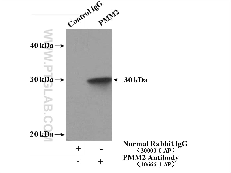 Immunoprecipitation (IP) experiment of mouse lung tissue using PMM2 Polyclonal antibody (10666-1-AP)