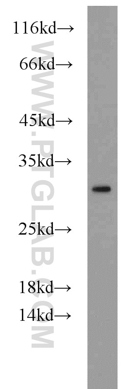 Western Blot (WB) analysis of HepG2 cells using PMM2 Polyclonal antibody (10666-1-AP)