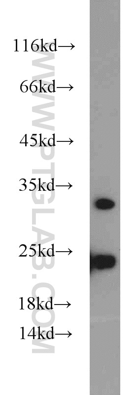 Western Blot (WB) analysis of HeLa cells using PMM2 Polyclonal antibody (10666-1-AP)