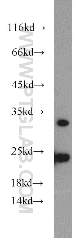 WB analysis of HeLa using 10666-1-AP