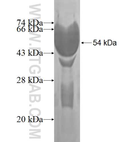 PMM2 fusion protein Ag1031 SDS-PAGE