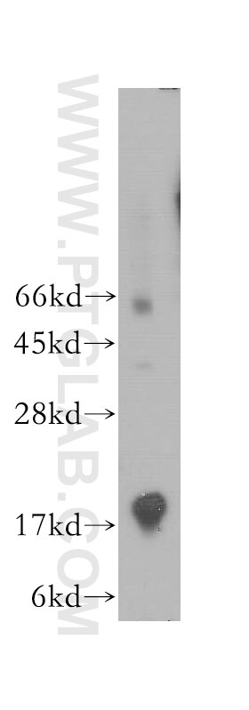 Western Blot (WB) analysis of human brain tissue using PMP2 Polyclonal antibody (12717-1-AP)