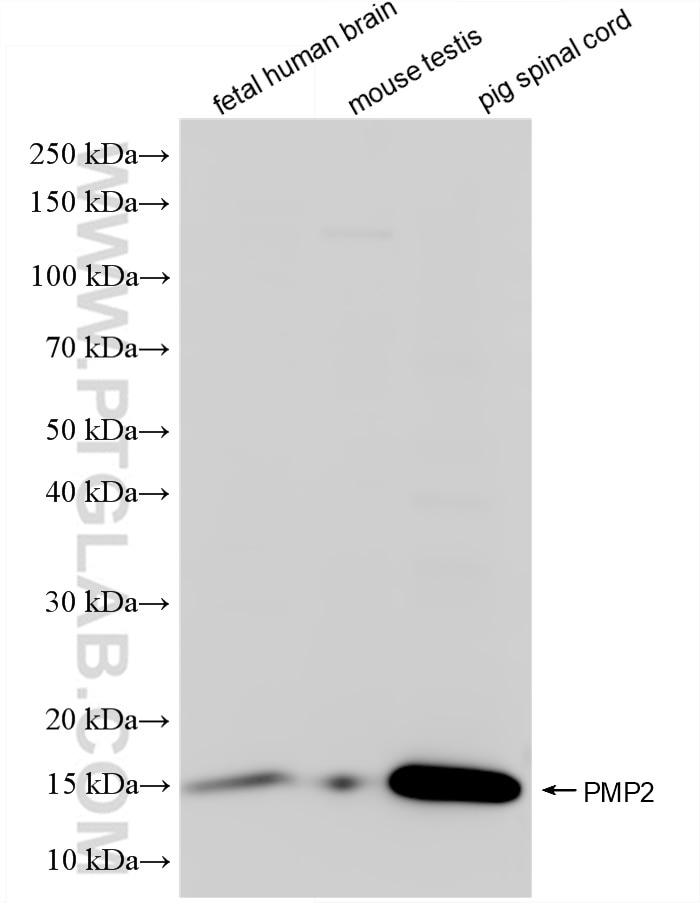 Western Blot (WB) analysis of various lysates using PMP2 Recombinant antibody (85594-5-RR)