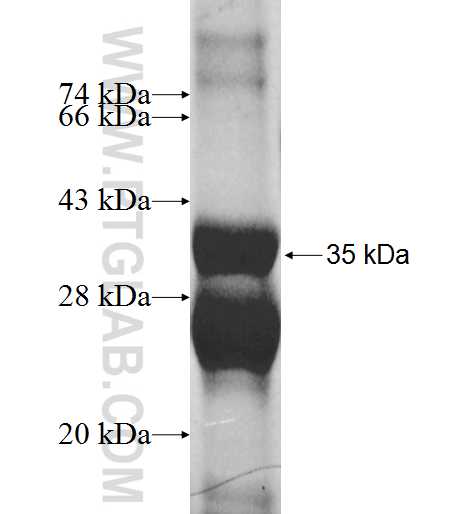 PMP22 fusion protein Ag9461 SDS-PAGE