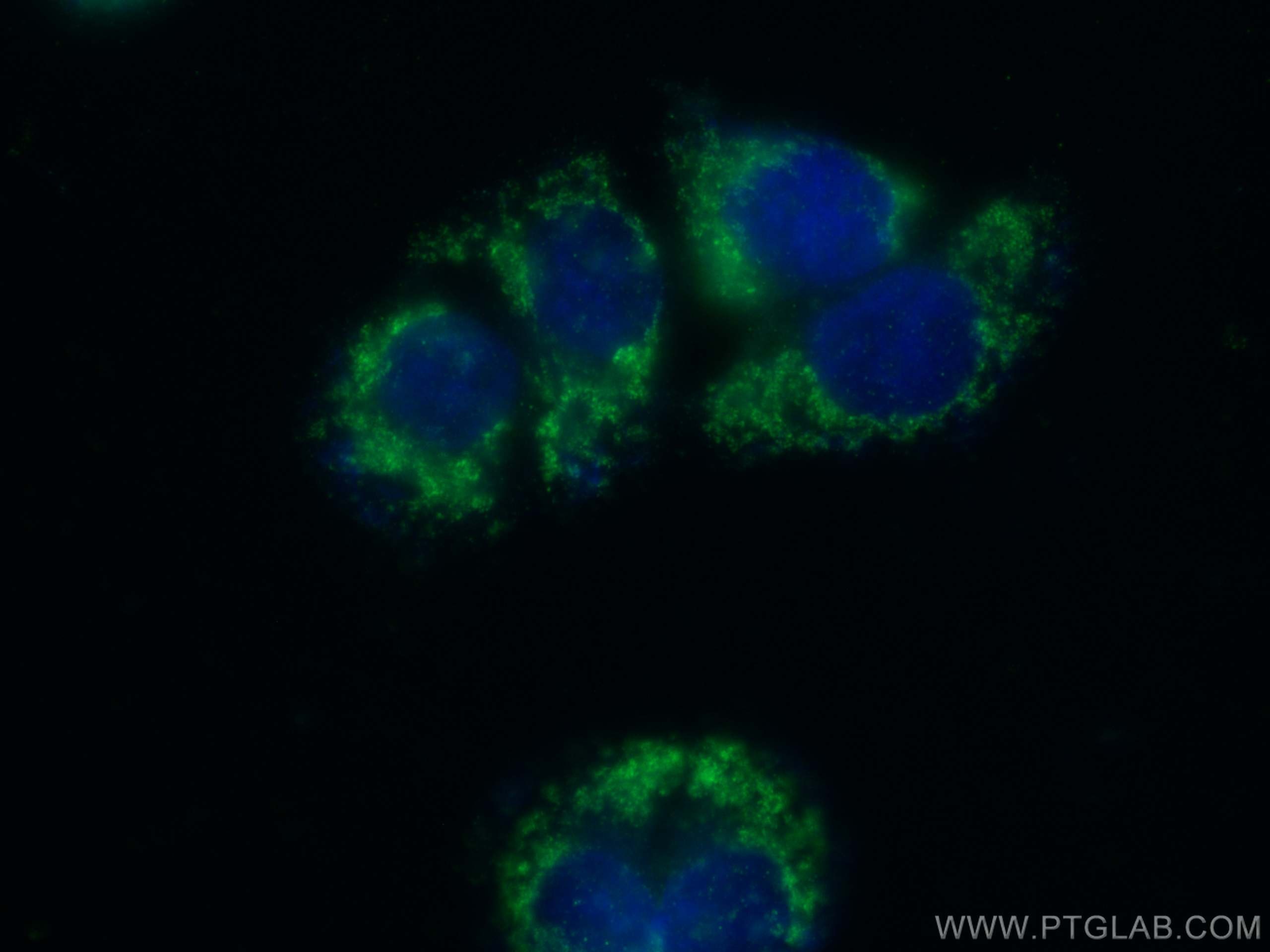 Immunofluorescence (IF) / fluorescent staining of T-47D cells using PMPCA Polyclonal antibody (26536-1-AP)
