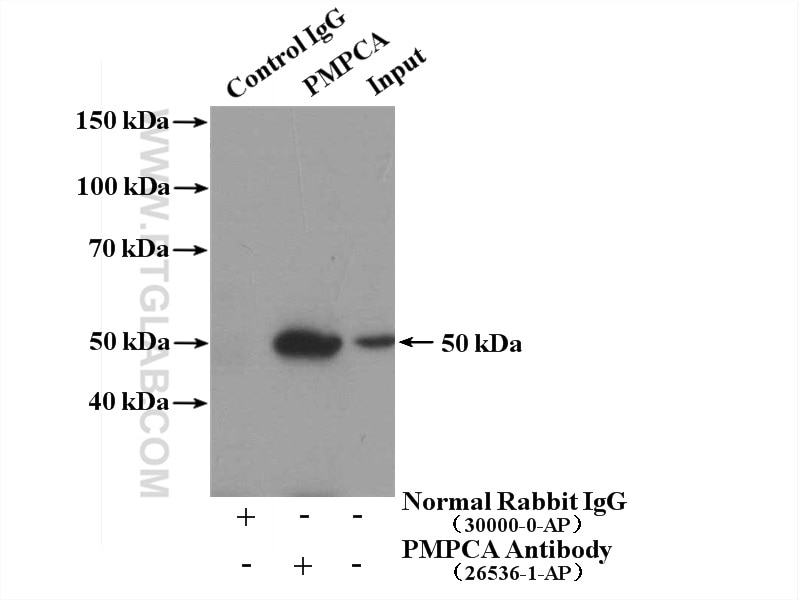 Immunoprecipitation (IP) experiment of MDA-MB-453s cells using PMPCA Polyclonal antibody (26536-1-AP)